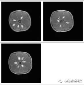 柠檬的磁共振成像